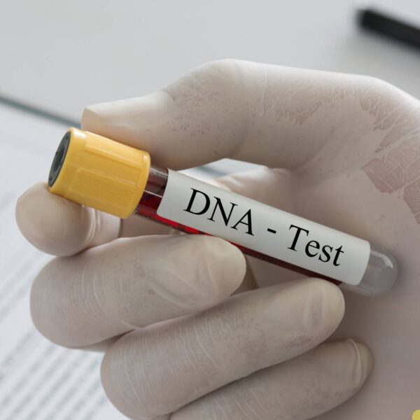 Skimmelsvamp Test (DNA prøve) - DNA test fra Skimmelconsult